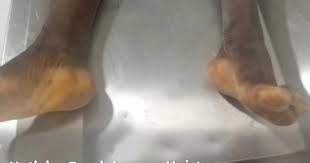 Haitiano mata a compatriota por sustraer aguacates en propiedad agrícola de Enriquillo, Barahona