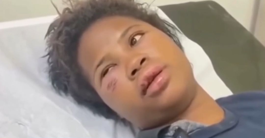 Joven denuncia que fue raptada de su trabajo y golpeada en monte por expareja