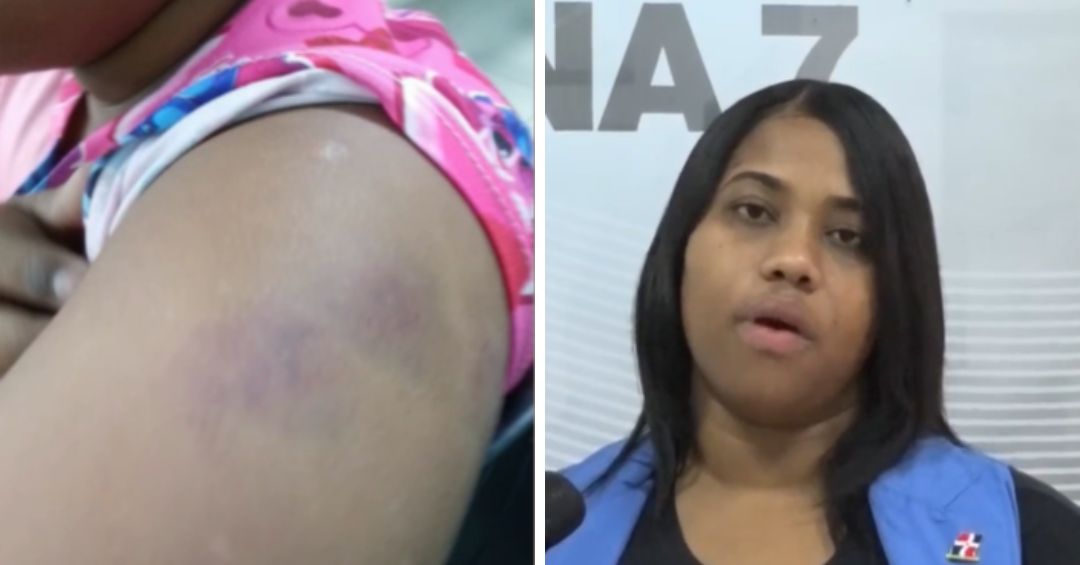 Madre denuncia que su hija de 8 años con síndrome de Down fue golpeada y mordida en guardería